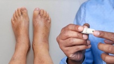 Đái tháo đường biến chứng khó ngủ, nóng rát đầu ngón chân điều trị thế nào?