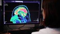 Trí tuệ nhân tạo (AI) có thể giúp điều trị u não nhanh và chính xác hơn