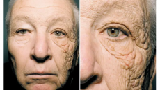 Hai nửa khuôn mặt khác biệt sau 28 năm tiếp xúc với ánh nắng mặt trời
