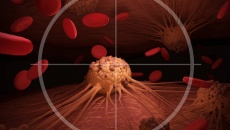 Đột phá: Một loại thuốc diệt tế bào ung thư đang thử nghiệm trên người ở Mỹ