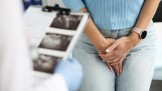 U xơ tử cung được điều trị ra sao?