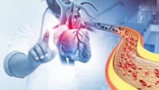 Mắc bệnh mạch vành nhưng không đặt được stent, sức khỏe yếu phải làm gì?