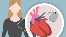 Đặt máy khử rung tim: Rủi ro và cách phòng tránh