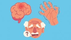 TPBVSK Vương Lão Kiện có tác dụng như thế nào với bệnh Parkinson?