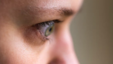 Bệnh Basedow có thể gây biến chứng lồi mắt