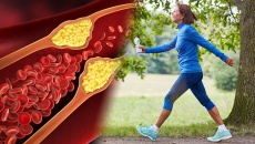 Tập thể dục thế nào để kiểm soát mỡ máu?
