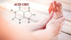 Các biện pháp giúp kiểm soát chỉ số acid uric máu 
