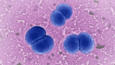 CDC Mỹ cảnh báo về vi khuẩn gây bệnh viêm não mô cầu hiếm gặp