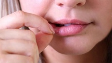 Cẩn trọng với thói quen bóc da môi 