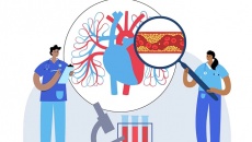 Triglyceride tăng cao gây ra biến chứng nào?