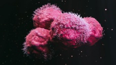 Đột phá: Nghiên cứu tìm ra 'chìa khóa' ngăn chặn ung thư di căn