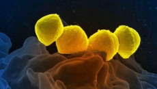Nhật Bản: Tăng đột biến số ca sốc nhiễm độc do vi khuẩn hiếm gặp
