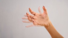 Run tay khi hồi hộp, căng thẳng: Nguyên nhân do đâu?
