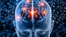 Bị Parkinson giai đoạn 4, mổ kích thích não sâu hiệu quả không?