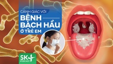 Podcast: Cảnh giác với bệnh bạch hầu ở trẻ em