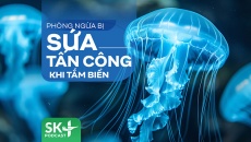 Podcast: Phòng ngừa sứa tấn công khi tắm biển