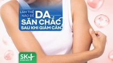 Podcast: Làm thế nào để da săn chắc sau khi giảm cân?