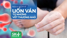 Podcast: Nguy kịch vì uốn ván từ những vết thương nhỏ