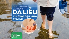 Podcast: Cảnh giác với các bệnh da liễu thường gặp mùa mưa lũ