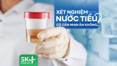 Podcast: Xét nghiệm nước tiểu có cần nhịn ăn không?