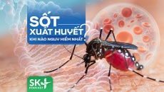 Podcast: Sốt xuất huyết khi nào nguy hiểm nhất?