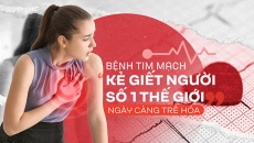 Bệnh tim mạch – “Kẻ giết người số 1 thế giới” ngày càng trẻ hóa