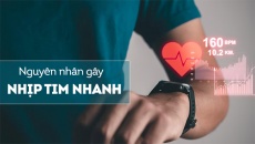 Nguyên nhân nào gây ra tình trạng tim đập nhanh?