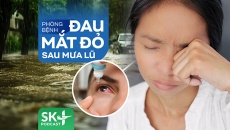 Podcast: Phòng bệnh đau mắt đỏ sau mưa lũ