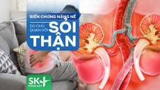 Podcast: Biến chứng nặng nề do chủ quan với sỏi thận