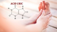 Tăng acid uric máu, làm sao để cải thiện?