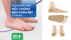 Podcast: Cách phát hiện hội chứng bàn chân bẹt ở trẻ em