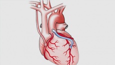 Hẹp mạch vành: Bắc cầu mạch vành có nguy hiểm không?