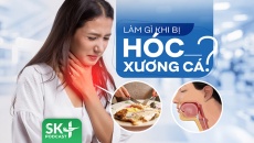 Podcast: Làm gì khi bị hóc xương cá?