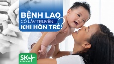 Podcast: Bệnh lao có lây truyền khi hôn trẻ?