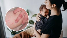 Những điều cần biết về bệnh tay chân miệng