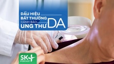 Podcast: Dấu hiệu bất thường cảnh báo Ung thư da