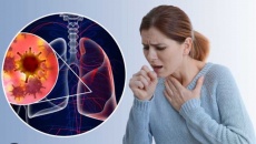 Viêm phổi nên ăn gì để chóng phục hồi?