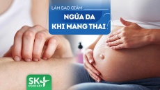 Podcast: Làm gì để khắc phục tình trạng ngứa da ở bà bầu?