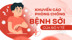 5 việc nên làm để phòng ngừa bệnh sởi