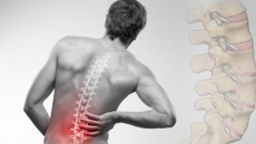 Thoát vị đĩa đệm L4-L5: Mức độ nguy hiểm và cách cải thiện từ thảo dược