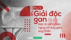 Tự ý “giải độc gan”: Bác sĩ cảnh báo nguy cơ suy gan, suy thận