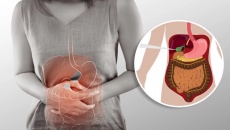 Làm thế nào để hết đau bụng, khó tiêu do sỏi mật 8mm?