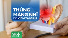 Podcast: Thủng màng nhĩ do viêm tai giữa