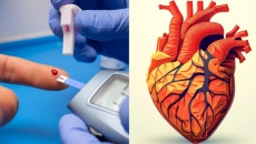 Bị xơ vữa động mạch vành kèm đái tháo đường: Nên ăn gì mới tốt? 