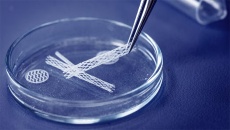Người bệnh tim có thể đặt tối đa bao nhiêu stent?