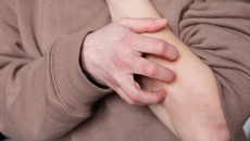 Làm thế nào để giảm ngứa do mề đay mạn tính hiệu quả? 