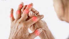 Thận trọng với những biến chứng nguy hiểm do bệnh gout gây ra