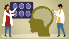 Làm thế nào để phát hiện sớm bệnh Alzheimer