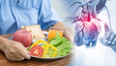 Người đặt stent mạch vành không nên ăn gì?