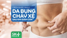 Podcast: Cách khắc phục da chảy xệ sau khi giảm cân
